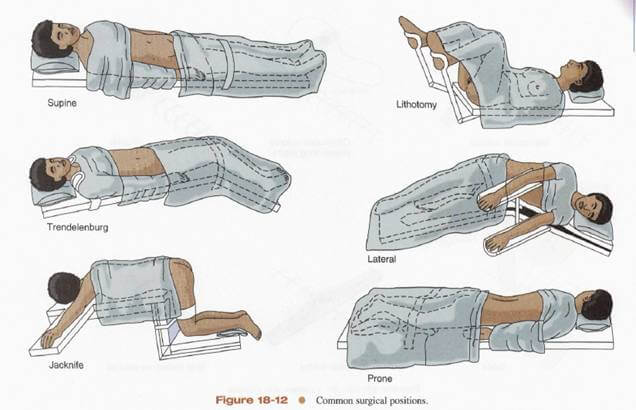 MEDSource, Inc - MED<em>Source</em>, Inc. Newsletter September 2017 – Surgical Positions ” width=”400″ height=”258″ class=”alignnone size-full wp-image-8703″ />Some common surgical positions are:  </p>
<ul style=